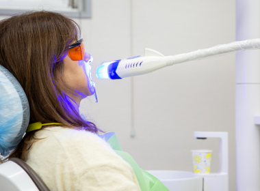 05 ホワイトニングとマウスピース